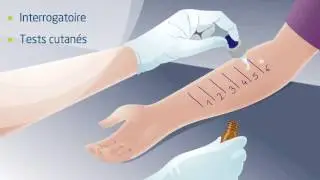 Qu'est-ce que l'immunothérapie allergénique ?