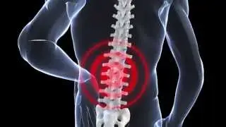 SPINAL DECOMPRESSION CHICAGO  &bull; 773-229-9600  &bull; Core Rehab Chicago