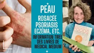 Peau: ecz&eacute;ma, psoriasis, rosac&eacute;e et autres probl&egrave;mes.  Truc SIMPLE qui aide la peau ET la digestion
