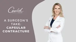 Are Your Breast Implants Hard And Painful? You Might Have Capsular Contracture