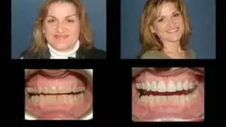 Markham Dentist Office - Family & Cosmetic Dentist in Markham