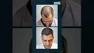 One Technique. Endless Transformations.Your journey is unique &mdash; your results, life-changing.