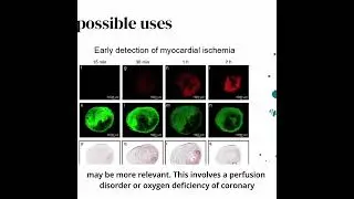 Mass Spectrometry Imaging (MALDI MSI) [ENGLISH]
