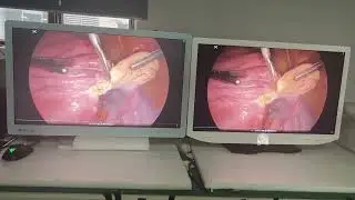 Reshin MS321PB 31.5-Inch 4K Surgical Monitor  vs Sony 32-Inch