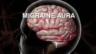 Serene Branson Update:  Migraine Can Mimic Stroke 2/18/2011