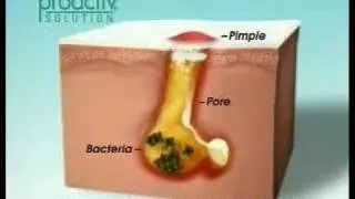 ProActive7