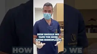 How should we tape the nose after Rhinoplasty?
