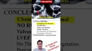नार्मल इको रिपोर्ट कैसे देखे l Normal Echo report l #ef #echo #shorts