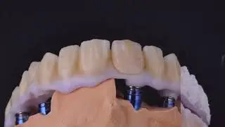 Pink and white porcelain layering technique.