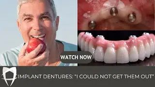 How retentive is an implant retained denture?