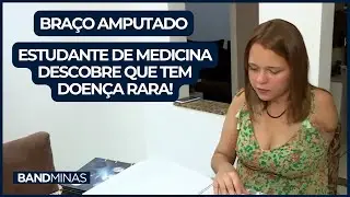 ESTUDANTE DE MEDICINA TEM BRAÇO AMPUTADO DEPOIS DE DESCOBRIR DOENÇA! | JORNAL BAND MINAS 08/09/2023