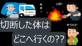 切断した身体の一部はどうなるのか？！ 下腿切断者が語ります！！ 火葬？ 廃棄処分？ 食べられる？！ 真相やいかに！！