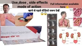 mega cv 625 tablet | mega cv 625 tablet kis kaam aati hai | amoxicillin potassium clavulanate 625 mg