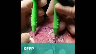 The Future of Hair Transplant is Here. Asmed Hair Transplant Clinic T&uuml;rkiye. Dr. Koray Erdoğan