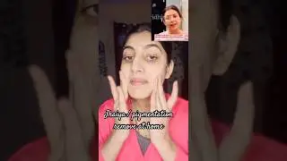 Melasma / Jhaiyan Ka 100% Cure | Pigmentation Treatment Naturally at home | instant glow facial #yt