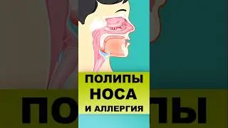 ПОЛИПЫ НОСА И АЛЛЕРГИЯ #полипыноса #полипы #аллергия