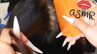 Ultimate Dry Scalp Relief ASMR 💆&zwj;♀️✨ | Close-Up Flake Lifting & Calm Tingles #DN544