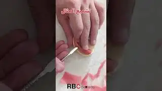 التعويضات المتحركة || طابع إفرادي للفك السفلي _ درد كامل