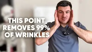 Look 15 Years Younger! This Facial Point Smooths Wrinkles Better Than Botox