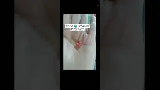 mini 🤏👤baby❤️ birth vlog🩺 #babybirthvlog  WORLD SMALLEST BABY 💯💥😍❤️