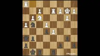Haha! I take white queen and checkmate my queen😱😱😱