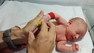 &ldquo;Establishing a peripheral IV line in a newborn &mdash; step-by-step guideline#neonatalicu 