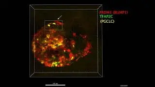 Researchers generate human embryo-like structures that include extraembryonic tissue