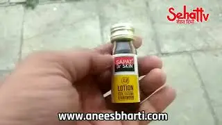 Sapat Dr Skin Lotion Uses Side effects Dose and Review|Sapat Lotion Hindi|Sapat Lotion Kaise lagaye