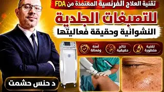 ما لا يذكرونه عن تقنية علاج الكاربوكسي لتفتيح البشرة/طريقة عملها/عدد و مدة الجلسات/آثارها و موانعها