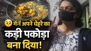 Chehra ❌ haldi ki dukaan ✅ 🥲| story in hindi | relatable stories| 