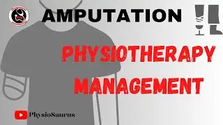Amputation | Physiotherapy management