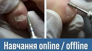Навчання педикюру онлайн та офлайн в Києві, апаратний педикюр 