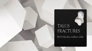 TALUS FRACTURES - NOTES FOR THEORY EXAM BY DR HARSHA 