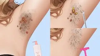 ASMR Animated Underarm Cleaning | Deep Pus Removal & Skin Treatment Sounds