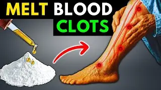 Morning Habits That Help Dissolve Blood Clots