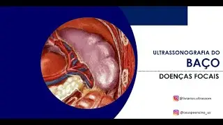 US do Baço: doenças focais