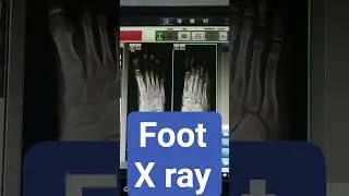 foot x ray  #medico #viral #drt #doctor #radiography #technology...