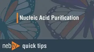 Quick Tips - How can I efficiently elute large DNA fragments from agarose gels?