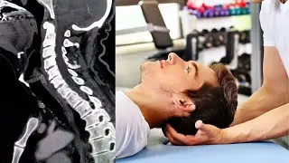 Unlocking Whiplash: An In-Depth Analysis with Dr. Jonathan Kuttner MD
