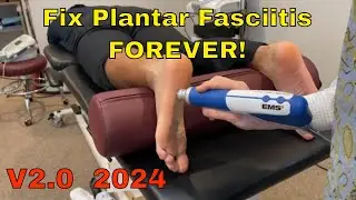 Plantar Fasciitis: Fix it FOREVER      V2.  2024