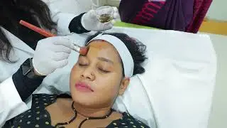 Best Chemical Peel for Glowing Skin | Dermatologist Treatment in Bangalore