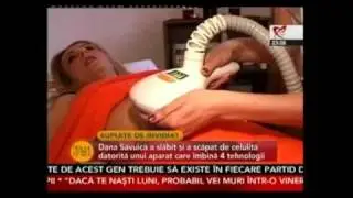 Vela Smooth - Slimart
