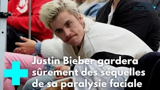 Justin Bieber souffre du syndrome de Ramsay Hunt - Le Magazine de la Santé