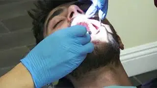 [Air Dental -  Burbank Dental Implants] Dental Fillings Temporary Crown