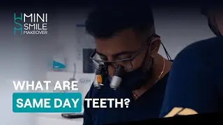 What are same day teeth?