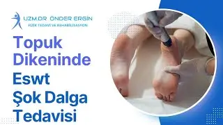 Topuk Dikenine ESWT(Şok Dalga)Tedavisi
