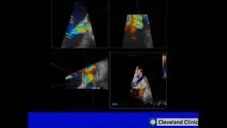 Valve imaging course- 3-1