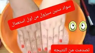 تبيض اليدين في 5 دقائق تفتيح اربع درجات ندمت ولاو ايدي بيض من وجهي 😨😨