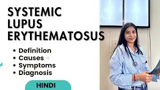 Systemic lupus erythematosus(SLE) in Hindi | Causes, Symptoms, Diagnosis & Treatment