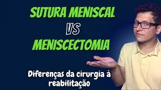Tratamento Conservador x Cirúrgico do Menisco: Sutura, Meniscectomia e Reabilitação Explicados